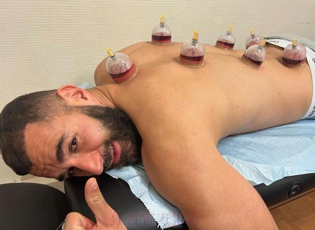 本泽马假期期间每天训练 今天接受了拔罐理疗